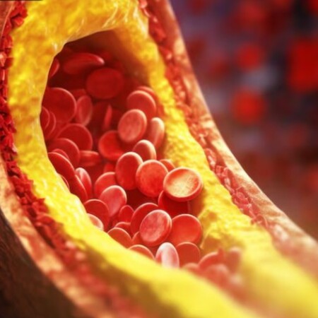 Υψηλή χοληστερόλη: Νέες οδηγίες - Τι ισχύει για συμπληρώματα διατροφής και κληρονομικότητα