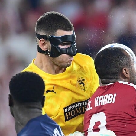 Champions League: Γιατί ο τερματοφύλακας της Πάφου φοράει μάσκα