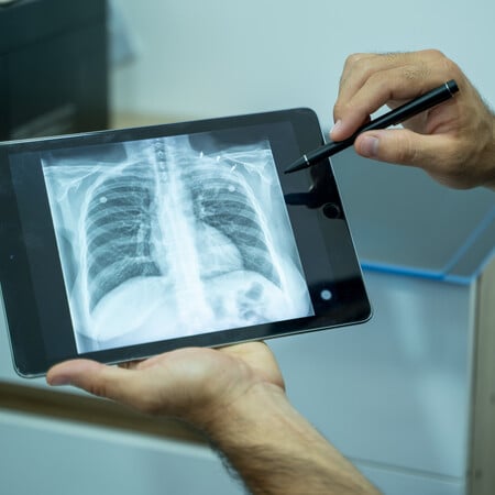 Καστοριά: Άνδρας βρέθηκε θετικός στη φυματίωση