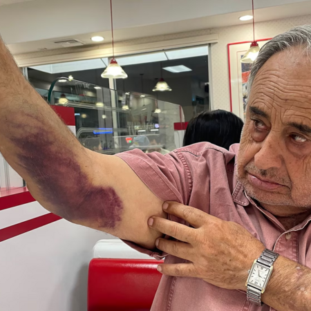 ΗΠΑ: 79χρονος πολίτης καταγγέλλει πράκτορες της ICE για βίαιη επίθεση – Ζητά 50 εκατ. δολάρια