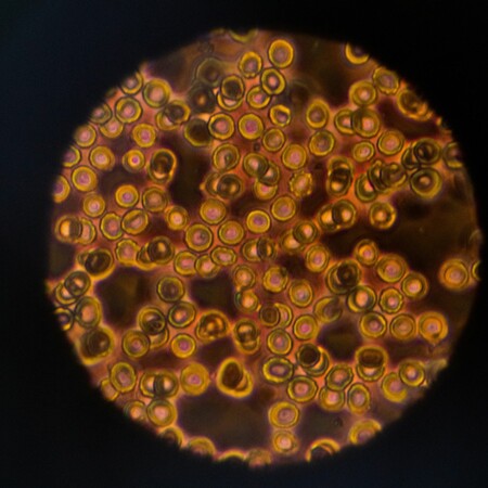 Ερευνητές δημιούργησαν ανθρώπινα ωάρια από κύτταρα του δέρματος