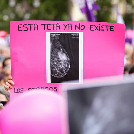 Μαστογραφία Ισπανία Καρκίνος του μαστού Σεβίλλη