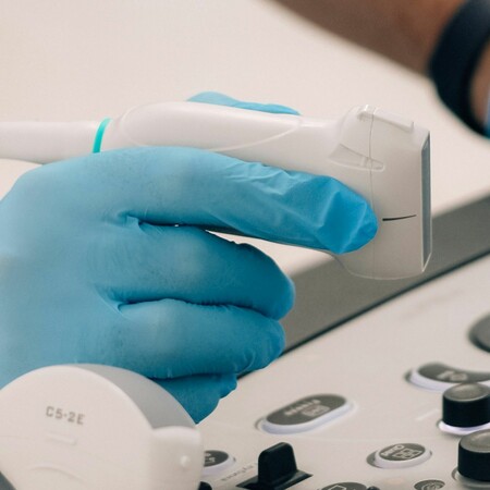 ΓΙΑ Σ/Κ: Πώς ένας απλός υπέρηχος λαιμού μπορεί να εντοπίσει τον κίνδυνο καρδιακής προσβολής και εγκεφαλικού