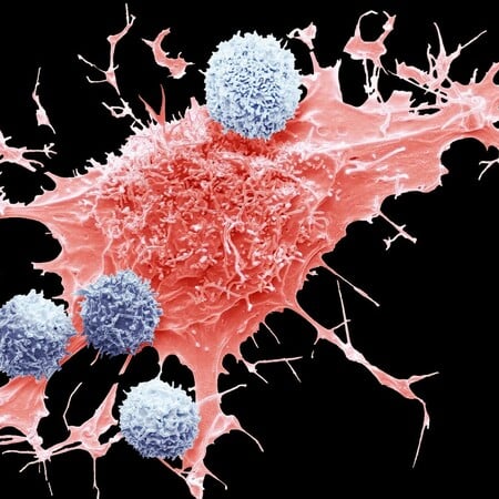 ΚΑΡΚΙΝΟΣ ΠΑΧΕΟΣ ΕΝΤΕΡΟΥ ΤΡΟΦΕΣ