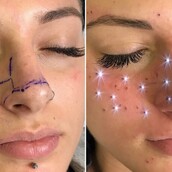 H νέα τάση στο τατουάζ ονομάζεται «astrofrecks» και συνδυάζει φακίδες και ζώδια