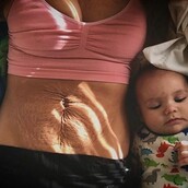 Η ωμή πραγματικότητα μετά την εγκυμοσύνη: Μητέρες δείχνουν περήφανες τα σημάδια στο σώμα τους