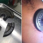 Πολύ ντροπιαστικό και κρίμα για τον φανατικό της γυμναστικής που σφήνωσε το πέος του σε βαράκι