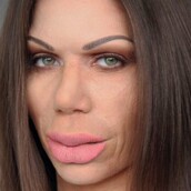 Τι συνέβη στη Στικούδη; - «Botox» δια χειρός αδελφών Αλαχούζων