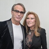 Η διάσημη για τις πλαστικές «γυναίκα -γάτα» συνελήφθη για επίθεση στον σύντροφό της