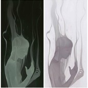 Παραισθησιογόνες υποσχέσεις***