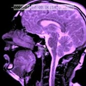 To πιο πρωτότυπο βίντεοκλιπ χρησιμοποιεί μαγνητικό τομογράφο