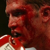 Φωτογραφίες πυγμάχων δείχνουν πόσο βίαιο είναι το άθλημα