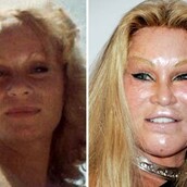 11 αποτυχημένες πλαστικές διασήμων