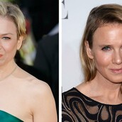 Πώς το πρόσωπο της Renee Zellweger δίχασε το ίντερνετ