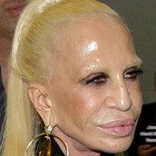 To πρόσωπο της Donatella Versace γίνεται (και πάλι) πρωτοσέλιδο στα tabloids
