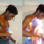 H νέα ηλίθια μόδα του ίντερνετ είναι να βάζεις φωτιά στον εαυτό σου