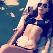 Η γυναίκα με τη νόσο του Crohn που τολμά και δείχνει το σώμα της