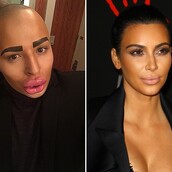 O 23χρονος που προσπάθησε να μοιάσει στην Κιμ Καρντάσιαν