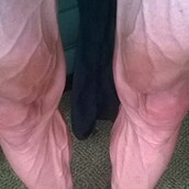 Ποδηλάτης του Tour De France έχει τα πιο τρομακτικά πόδια στο internet