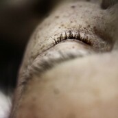 Πώς είναι η αίσθηση του θανάτου; Ένας άνδρας που πέθανε δύο φορές απαντά