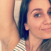 "Οι πριγκίπισσες έχουν τρίχες"- Οι Γαλλίδες υπερασπίζονται μια 16χρονη και την τριχοφυΐα στο σώμα τους