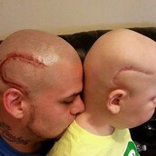 Του είπε πως τώρα ο κόσμος θα κοιτάζει περίεργα και τους δύο και έκανε τατουάζ την ουλή του