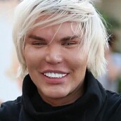 Ψεύτικοι κοιλιακοί και νέα μαλλιά: Ο «άνθρωπος Ken» έκανε την 59η πλαστική επέμβαση και συνεχίζει...