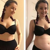 12 «Πριν & Μετά» παραδείγματα που θα σας κάνουν να αναθεωρήσετε όσα βλέπετε στα social media