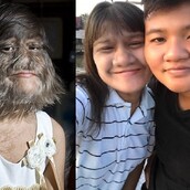 Το «πιο τριχωτό κορίτσι του κόσμου» παντρεύτηκε και αποφάσισε πλέον να ξυρίζει το πρόσωπό της