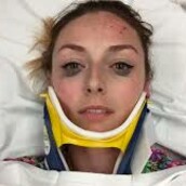 Μια 25χρονη γράφει για το πώς μετά από τροχαίο το eyeliner της έμεινε άθικτο και ξαφνικά το ίντερνετ ενθουσιάζεται