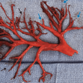 Doctors Aren’t Sure How This Even Came Out of a Patient