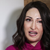 Εκτάκτως στο νοσοκομείο η Ιωάννα Παλιοσπύρου: Το χέρι μου έβγαζε αίμα 