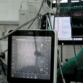 ΑΓΡΙΝΙΟ ΝΟΣΟΚΟΜΕΙΟ ΜΕΤΑΜΟΣΧΕΥΣΗ ΗΠΑΤΟΣ