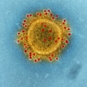 ΓΡΙΠΗ ΠΤΗΝΩΝ COVID