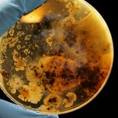 Ευρώπη: Σε άνοδο τροφικές δηλητηριάσεις που συνδέονται με εξαιρετικά ανθεκτικό βακτήριο