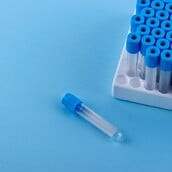 Γιατί δεν εντοπίστηκε το καρκινικό γονίδιο στο σπέρμα δότη που χρησιμοποιήθηκε για τη σύλληψη 197 παιδιών