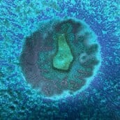 Επιστήμονες έφτιαξαν αντίγραφο του ενδομητρίου και εμφύτευσαν έμβρυα σε πρώιμο στάδιο