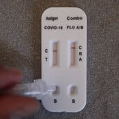 ΓΡΙΠΗ ΝΟΣΟΚΟΜΕΙΑ ΜΕΘ ΕΟΔΥ