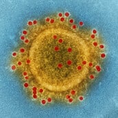 Nipah: Τι είναι, πού εντοπίζεται και πώς μεταδίδεται ο επικίνδυνος ιός