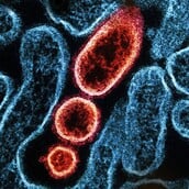 ΙΟΣ ΝΙΠΑ NIPAH 