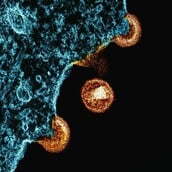 HIV ΘΕΡΑΠΕΙΑ ΧΑΠΙ