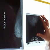 ΤΕΧΝΗΤΗ ΝΟΗΜΟΣΥΝΗ ΜΑΣΤΟΓΡΑΦΙΑ