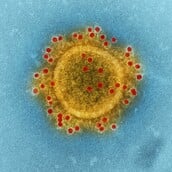 ΚΑΡΚΙΝΟΣ ΑΝΟΣΟΘΕΡΑΠΕΙΑ