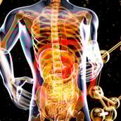 ΣΥΚΩΤΙ ΛΙΠΩΔΗΣ ΝΟΣΟΣ ΤΟΥ ΗΠΑΤΟΣ