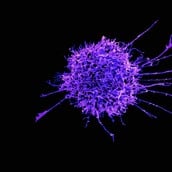 ΕΡΕΥΝΑ ΚΑΡΚΙΝΟΣ ΚΥΤΤΑΡΑ ΓΕΝΕΤΙΚΗ