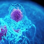 ΚΑΡΚΙΝΟΣ ΠΑΓΚΡΕΑΣ ΤΕΧΝΗΤΗ ΝΟΗΜΟΣΥΝΗ ΕΝΤΟΠΙΣΜΟΣ 