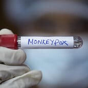 MPOX ΗΠΑ ΕΡΕΥΝΗΤΕΣ ΙΟΣ