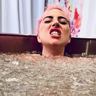 Ακτινογραφία σε όλο το σώμα της Lady Gaga μετά την σοκαριστική πτώση