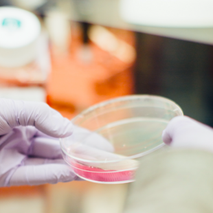 EMA: Ξεκινά την αξιολόγηση αντιφλεγμονώδους φαρμάκου για ασθενείς με σοβαρή λοίμωξη Covid-19