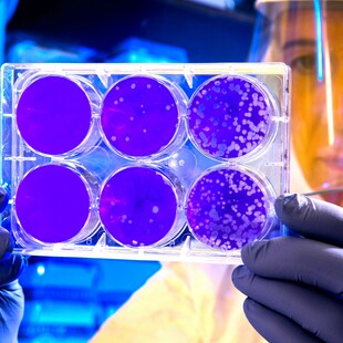 Antimicrobial resistance now a leading cause of death worldwide, study finds